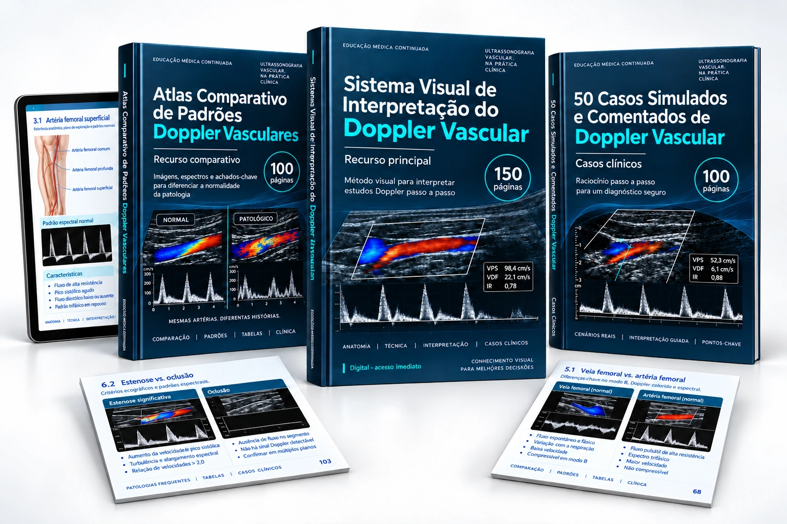 Sistema Visual, Atlas Comparativo e 50 Casos Simulados e Comentados de Doppler Vascular
