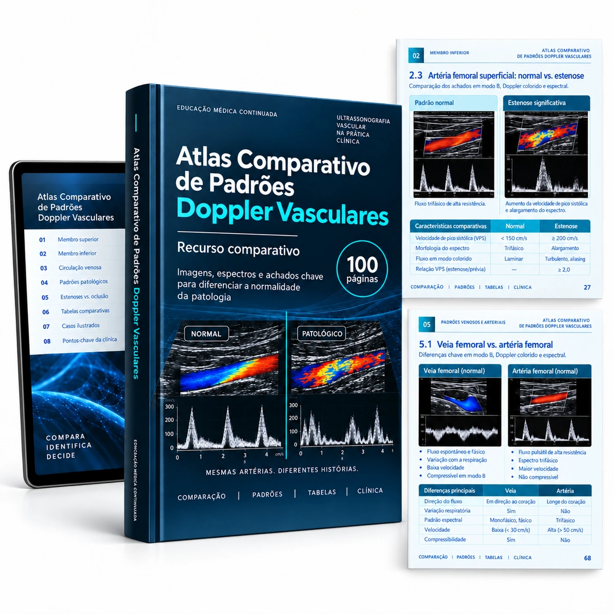 Representação digital: Atlas Comparativo de Padrões Doppler Vasculares