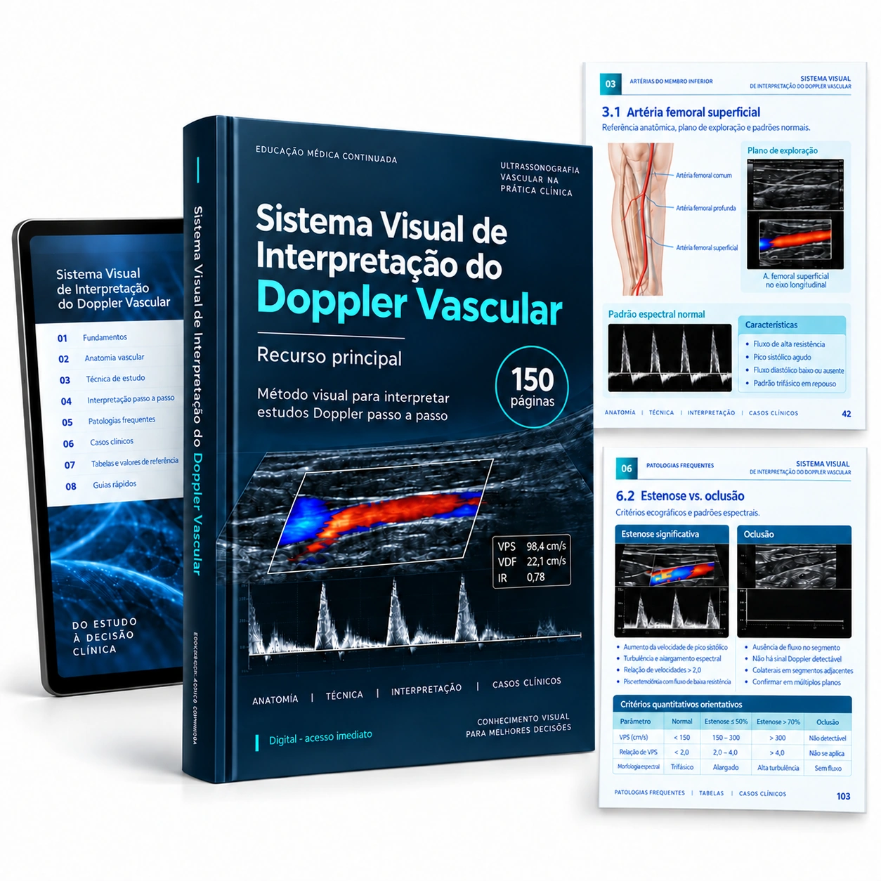 Representação digital: Sistema Visual de Interpretação do Doppler Vascular