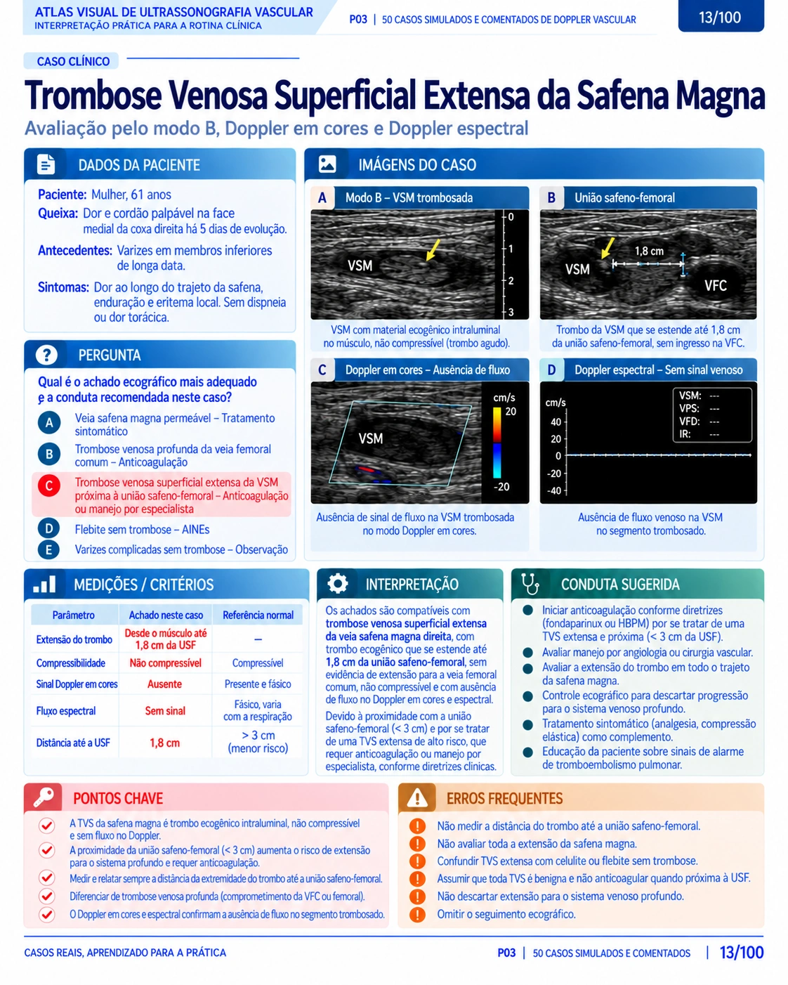 Página 13: Caso: trombose venosa superficial. Amostra do material digital de Doppler vascular.